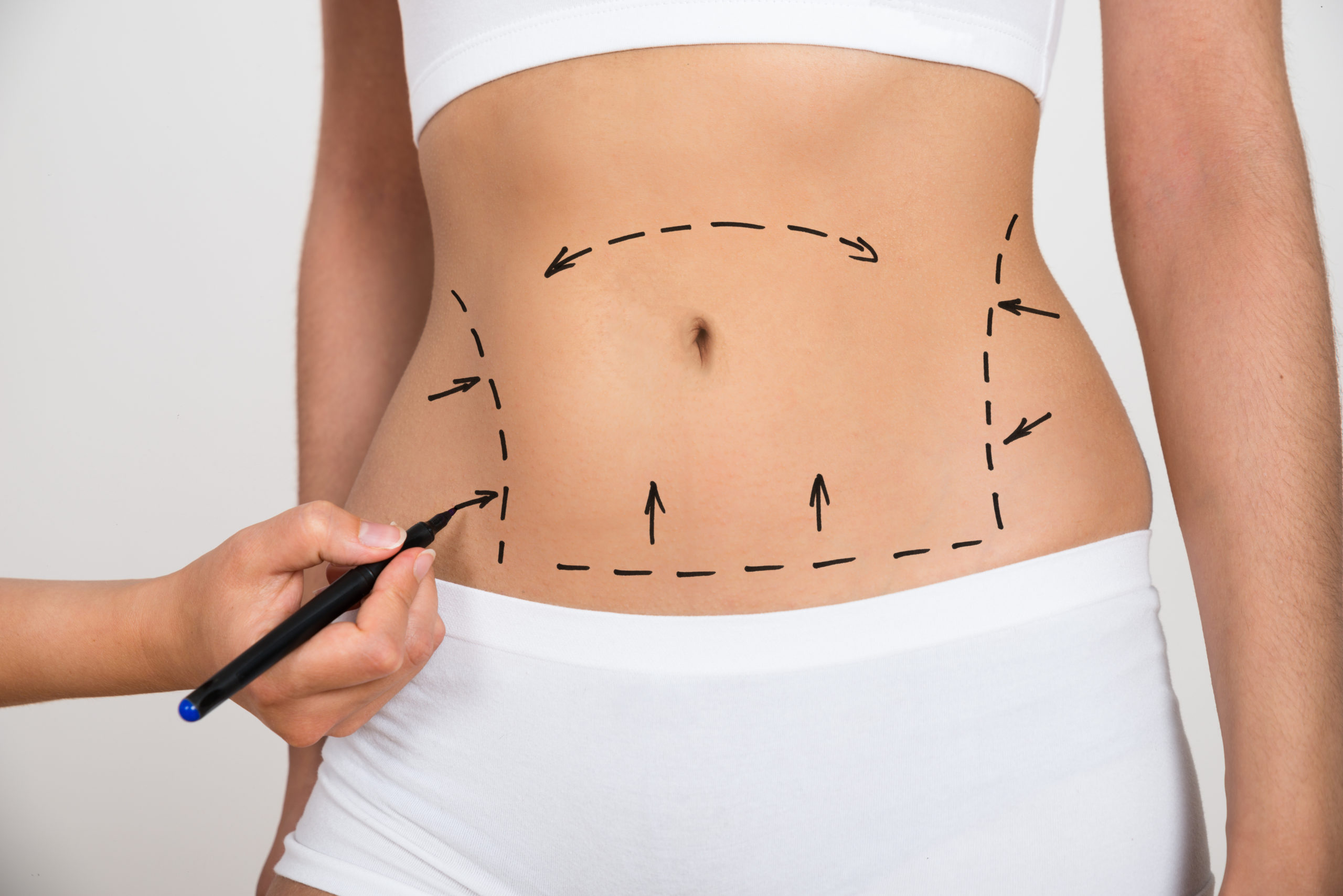 Body Contouring vs. Plastic Surgery: Which Is The Best Option For You?
